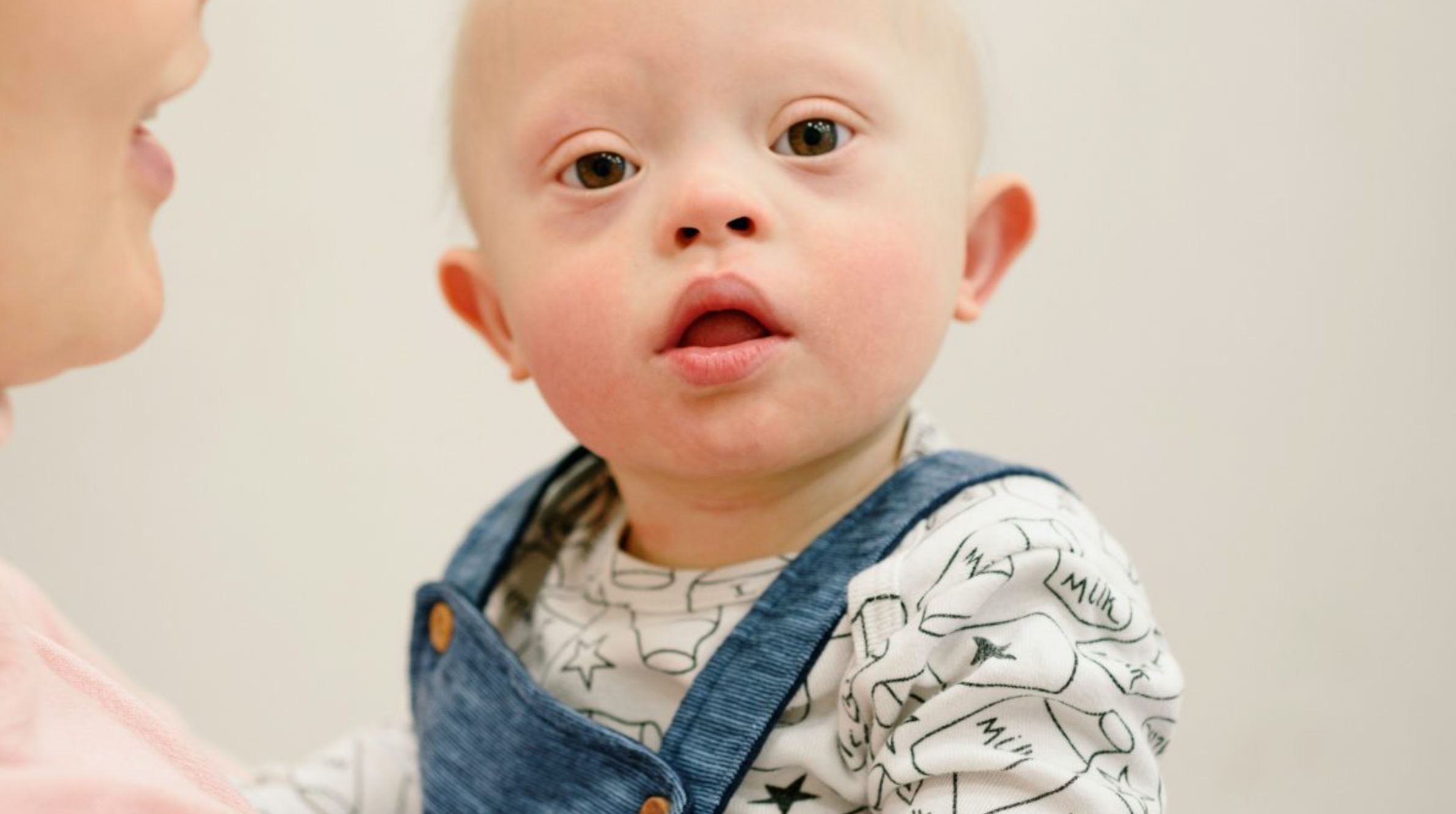 Modern medicine is changing the prognosis for kids with Down syndrome 